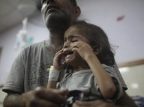 Potret Miris Anak-anak di Gaza Tersiksa Karena Malnutrisi