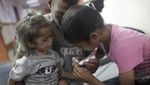 Potret Miris Anak-anak di Gaza Tersiksa Karena Malnutrisi