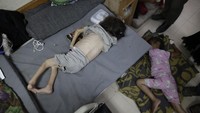 Persediaan makanan yang minim membuat anak-anak mereka kekurangan makanan.