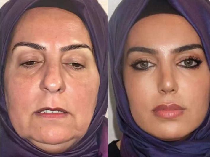 before after kakek dan nenek before after kakek dan nenek