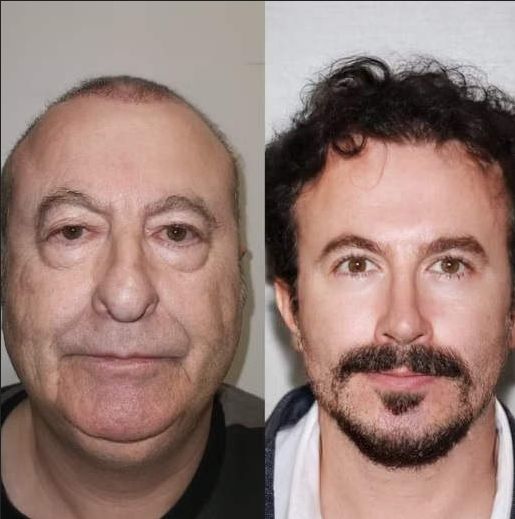 before after kakek dan nenek before after kakek dan nenek