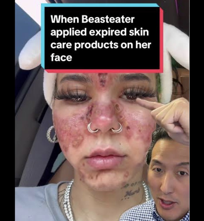 Skincare kedaluwarsa