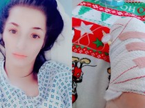 Menyoal Pemicu Lecet di Kaki Wanita Inggris Bisa Berujung Fatal hingga Diamputasi