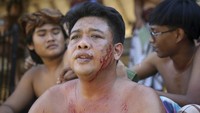 Meski begitu, mereka mempunyai obat anti septik dari bahan umbi-umbian yang akan diolesi ke luka tersebut. Hingga akhirnya luka akan mengering dan sembuh.   