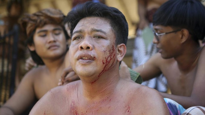 Aksi Berani Pria di Bali Ikut Perang Pandan Berduri A man helps remove pandanus thorns from his friend wounds during ritual called 'Mekare-kare' pandanus war at Tenganan village in Bali, Indonesia on Wednesday, June 5, 2024. People of Tenganan village celebrate a month long ceremony called 'Usabha Sambah' to honour and respect the God Indra, the Hindu god of war. (AP Photo/Firdia Lisnawati)