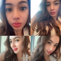 Nah sekarang tulang yang menonjol sudah nggak ada, dan hidungku sudah nggak miring... Jadi lebih bagus kan rata... tulisnya di unggahan Instagram. Foto: Instagram/@realangelkaramoy