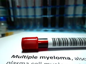 Sering Disangka Saraf Kejepit, Waspadai Gejala Kanker Multiple Myeloma