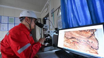 Hasil tangkapan mikroskop ditayangkan di layar besar. Foto: Xinhua