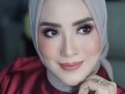 Kisah Elma Theana yang Sempat Trauma Filler, Kini Lebih Bijak Pilih Dokter