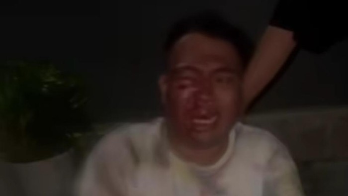 Heboh di medsos warga Bitung diduga dianiaya oknum polisi.