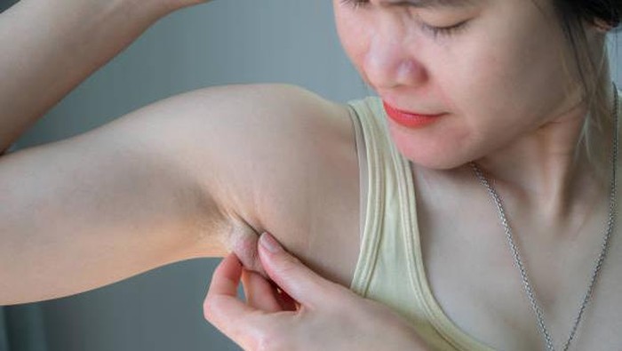 10 Penyebab Kelenjar Getah Bening Membengkak dan Cara Mengatasinya