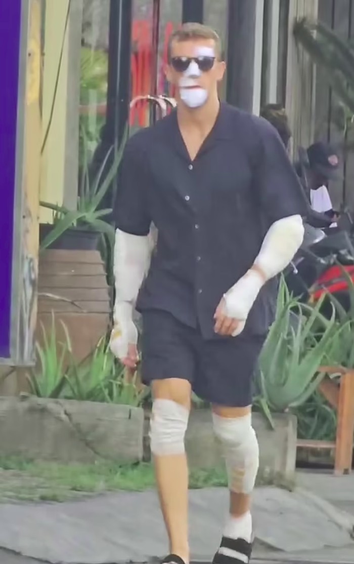 Bule Bali dapat Bali Kiss