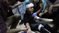 Sebanyak 85.037 orang juga terluka di jalur Gaza sejak perang Israel vs Hamas. AP Photo/Saher Alghorra  
