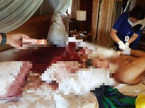 Bule Amerika Ditemukan Bersimbah Darah di Kamar Vila Ubud