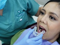 Implan Gigi Digital Solusi untuk Si Gigi Ompong