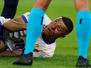 Hidungnya Patah, Mbappe Absen di Sisa Laga Fase Grup?