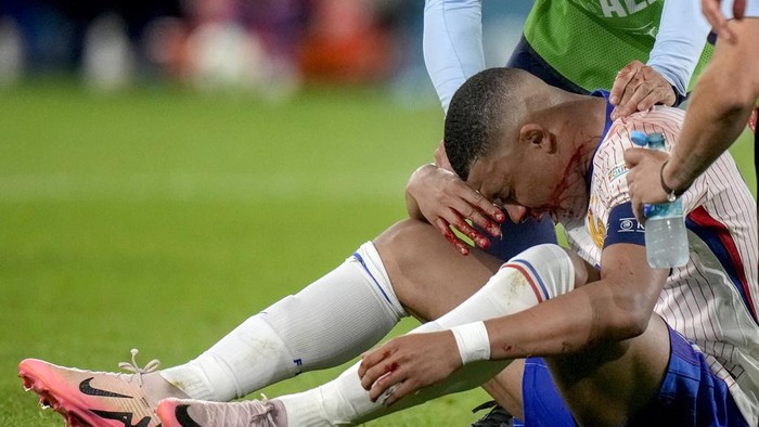 Kylian Mbappe of France receives a treatment after suffering an injury during a Group D match between Austria and France at the Euro 2024 soccer tournament in Duesseldorf, Germany, Monday, June 17, 2024. (AP Photo/Alessandra Tarantino)
