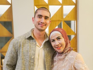 Verrell Bramasta Rayakan Idul Adha dengan Rambut Baru Usai Transplantasi di Turki