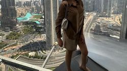 Penampilan Angel Karamoy Curi Perhatian Liburan ke Dubai Usai Operasi Plastik