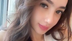 Penampilan Angel Karamoy Curi Perhatian Liburan ke Dubai Usai Operasi Plastik