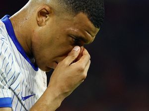 Euro 2024: Mbappe Akan Jalani Operasi karena Patah Hidung