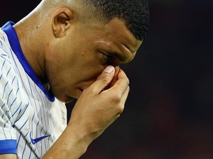 Mbappe akan Absen Akibat Cidera Patah Hidung, Prancis Optimis dengan Skuadnya