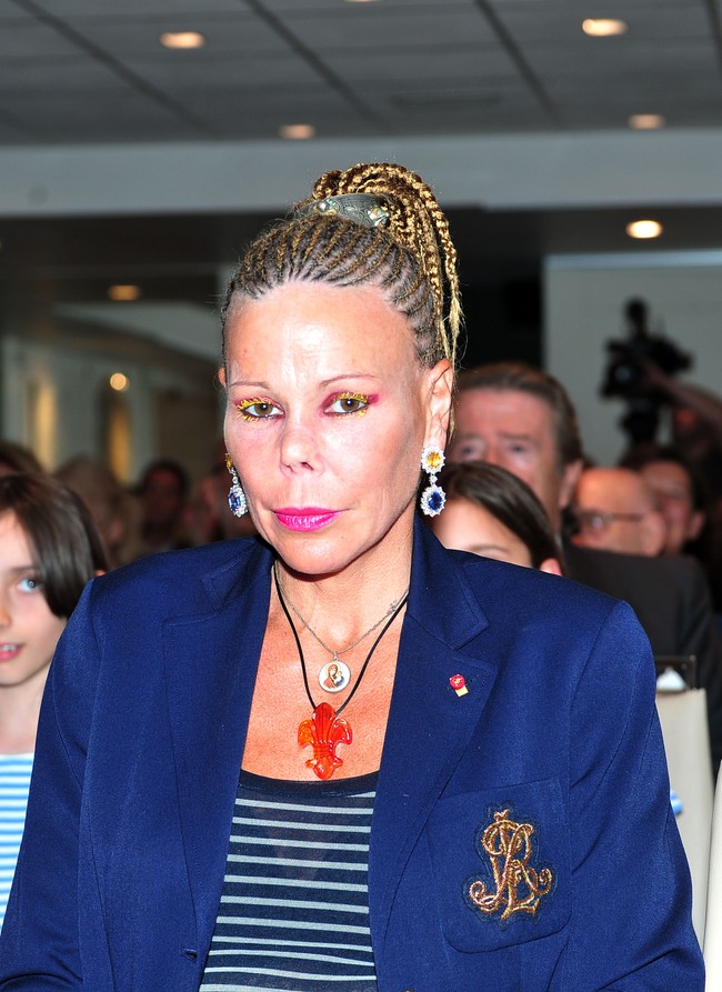 Selain tubuh atletisnya, hidung Putri Kalina juga menjadi topik pembicaraan. Banyak yang berspekulasi bahwa sang putri menjalani operasi plastik. Namun, sang suami membantah rumor ini pada tahun 2018, mengungkapkan bahwa perubahan fisik Kalina berkaitan dengan masalah kesehatan pribadi. Foto: Getty Images