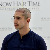 Dalam keterangan unggahannya Verrel mengaku jika dirinya memilih tanam rambut karena merasa garis rambutnya sudah mulai ke belakang dan tidak rata. Hal tersebut bisa diakibatkan karena Verrel kerap menggunakan banyak produk rambut, seperti,gel, wax, ataupun hairspray. Foto: Instagram/@bramastavrl