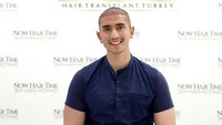 Verrell Bramasta transplantasi rambut karena merasa bagian garis kepalanya itu mengalami penyurutan. (Foto: dok Instagram)
