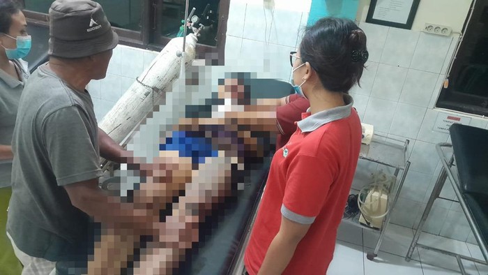 Korban tewas akibat kecelakaan di jalur Sidemen-Klungkung saat dievakuasi di Puskesmas Sidemen, Karangasem, Kamis (20/6/2024). (Dok. Polsek Sidemen)