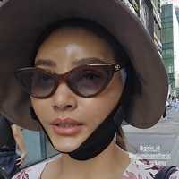 Di hari kedua bengkak di bagian pipi Sarwendah mulai terlihat berkurang. Namun bengkaka di bagian lipatan matanya masih terlihat jelas. Foto: Instagram/@sarwendah29