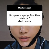 Sarwendah menjelaskan tindakan yang dilakukannya berupa pemindahan lemak dari badan ke wajah agar terlihat lebih fresh. Selain itu ia juga melakukan koreksi pada bagian matanya karena memiliki cukup banyak kerutan di daerah kelopak mata. Foto: Instagram/@sarwendah29