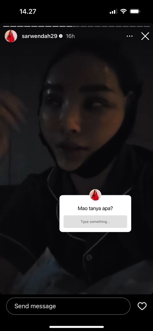 Meski dengan wajah diperban, Sarwendah juga sempat membuka tanya jawab di akun Instagram Storynya. Dalam sesi tanya jawab tersebut Sarwendah mengaku sudah ingin menjalani tindakan tersebut sejak 10 tahun lalu. Foto: Instagram/@sarwendah29