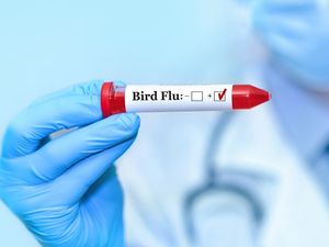 Video: CDC AS Akhiri Respons Darurat Flu Burung H5N1