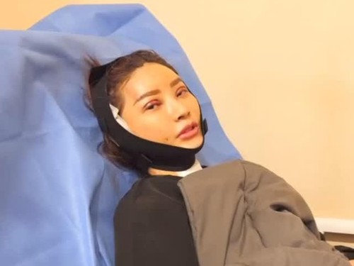 Sarwendah usai operasi plastik di Korea.