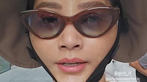 Kondisi bengkak di wajah Sarwendah wajar setelah prosedur bedah kosmetik dan akan berangsur membaik. Foto: Instagram Sarwendah