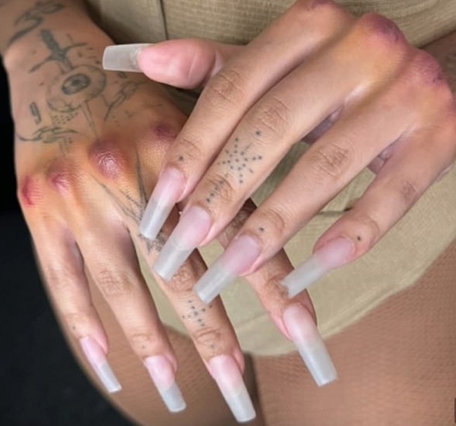 Tangan Doja pun terlihat lebam-lebam. Namun semua itu hanyalah aksi panggungnya. Foto: Instagram