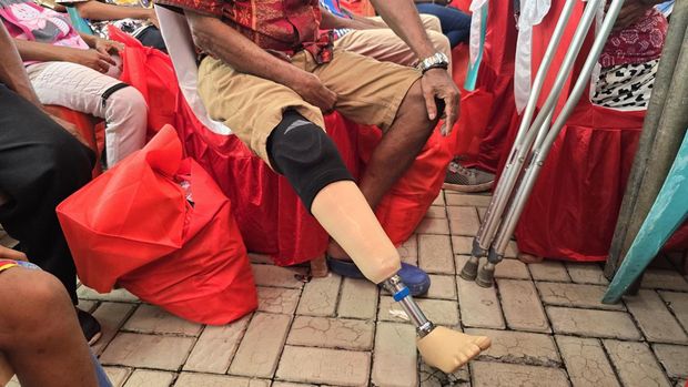 Klautidus saat menerima bantuan kaki palsu (Wilda/detikcom)