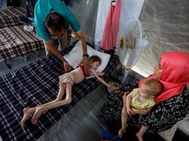 Potret Pilu Anak-anak di Gaza Menderita Malnutrisi