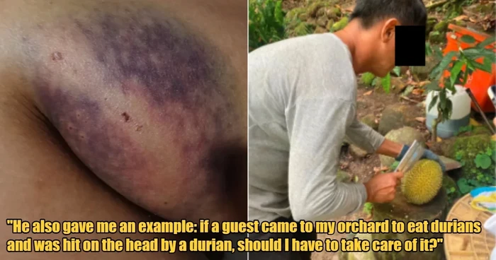 Sedang Asyik Makan Durian, Turis  Ini Apes Digigit Anjing