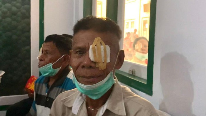 Yohanis warga di Maluku usai operasi katarak