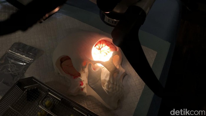 Bisa Mengancam Jiwa, Kenali Gejala Pecah Pembuluh Darah Otak saat Bangun Tidur