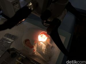 Bisa Mengancam Jiwa, Kenali Gejala Pecah Pembuluh Darah Otak saat Bangun Tidur