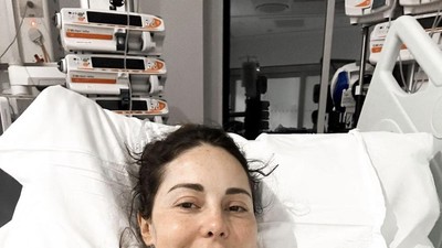 Foto Bintang Reality TV yang Hidup Pakai Kantung Stoma di Perut