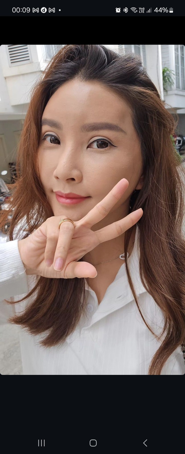 Sarwendah melakukan operasi hidung di Jakarta. Namun operasi yang dilakukannya ini menurutnya bukan untuk tujuan estetis. Ini aku bukan operasi buat hidung mancung ya guys. Aku melakukan operasi ini karena sinus, ujar artis yang tengah proses cerai dengan Ruben Onsu itu dalam unggahan video di Instagram. Foto: dok. Instagram Sarwendah