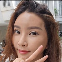 Sarwendah melakukan operasi hidung di Jakarta. Namun operasi yang dilakukannya ini menurutnya bukan untuk tujuan estetis. Ini aku bukan operasi buat hidung mancung ya guys. Aku melakukan operasi ini karena sinus, ujar artis yang tengah proses cerai dengan Ruben Onsu itu dalam unggahan video di Instagram. Foto: dok. Instagram Sarwendah