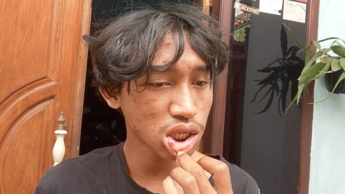 Pemuda di Kota Malang dikeroyok