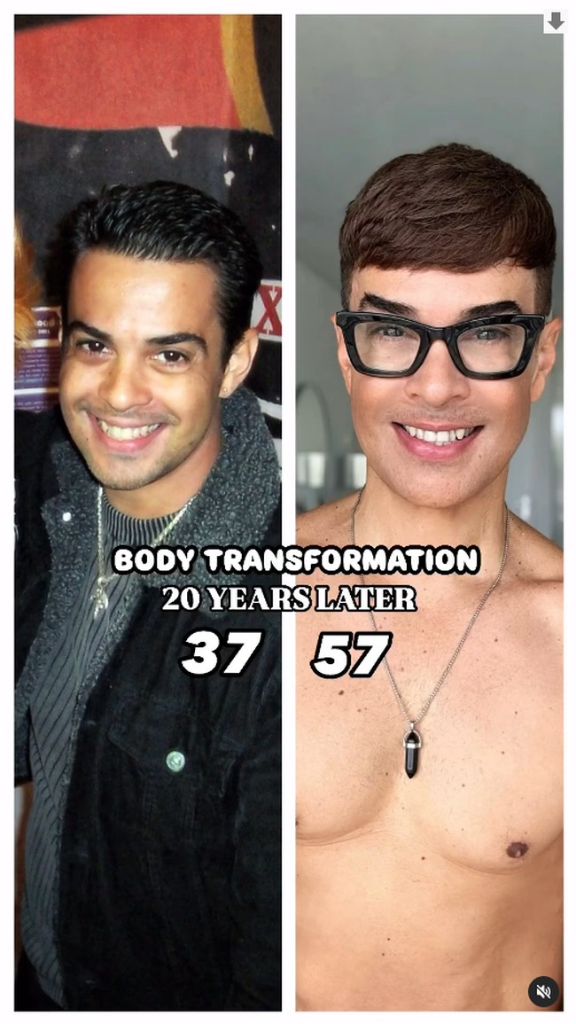 Lebih plastik dari Ken, Hasil operasi plastik dan Botox, Pria itu terlihat seperti buatan AI, Eksperimen Botox, tulis netizen di kolom komentar. Foto: Instagram Edson Brandao