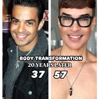 Lebih plastik dari Ken, Hasil operasi plastik dan Botox, Pria itu terlihat seperti buatan AI, Eksperimen Botox, tulis netizen di kolom komentar. Foto: Instagram Edson Brandao