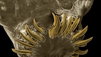 Scolex cacing pita. Scolex adalah bagian kepala cacing pita. Scolex dilengkapi dengan sucker (penghisap) dan kait. Fungsinya adalah untuk menempel pada dinding usus inang. Foto: David Maitland via Petapixel